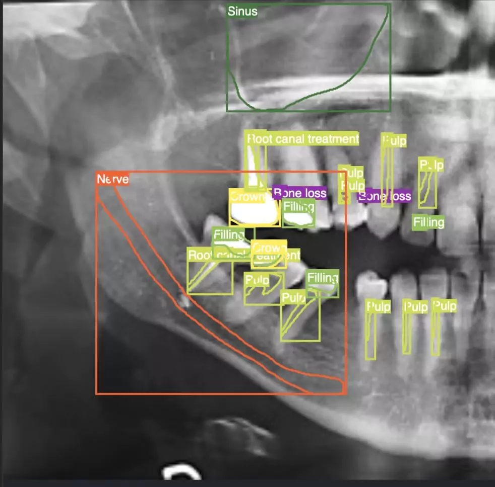 Oral Surgery