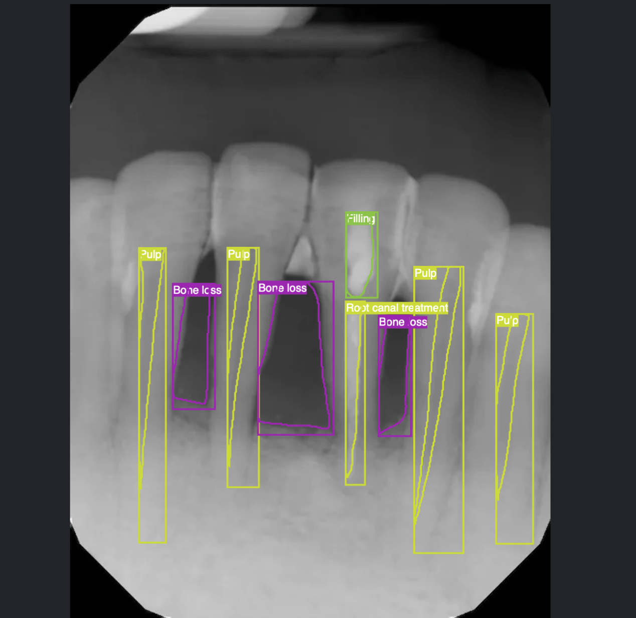 Periodontics